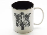 Human Anatomy Mugs Cup gift set black white anatomical heart medical home decor gothic skull coffee tea kitchen macabre halloween spooky-Art Altered